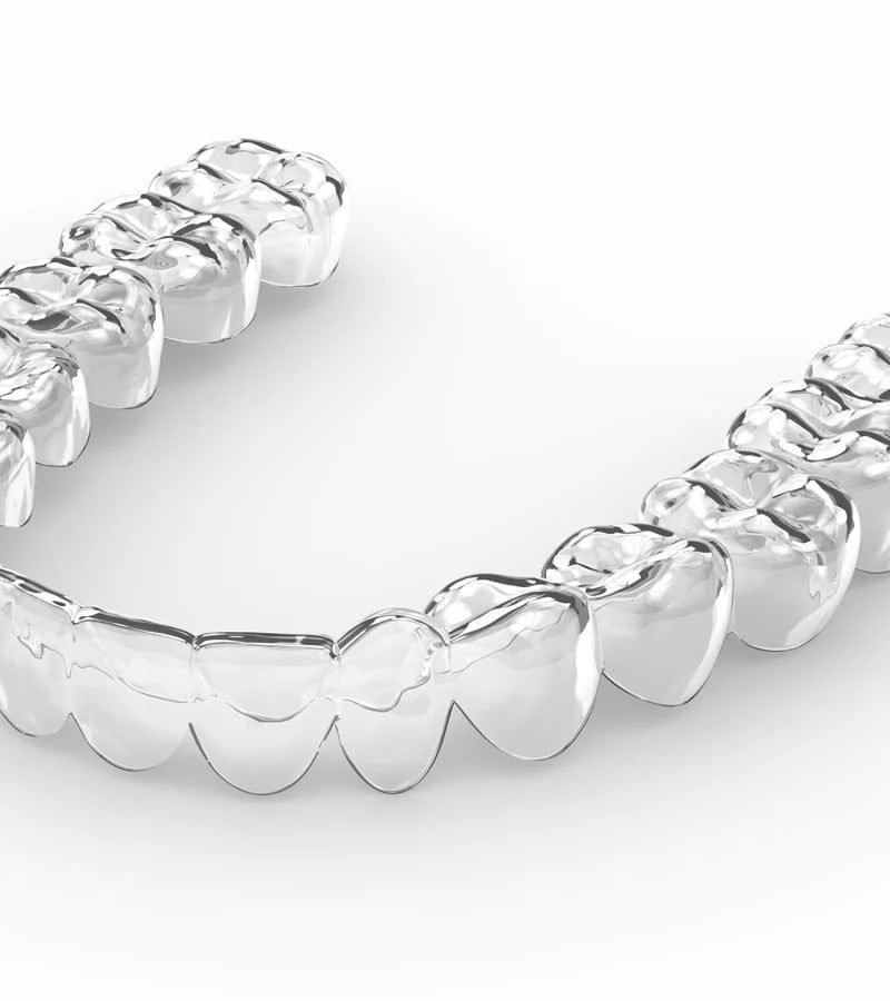 an invisalign or smilers clear aligner