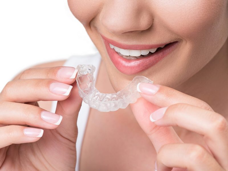 woman about to wear clear braces (invisalign and smilers) to straighten teeth