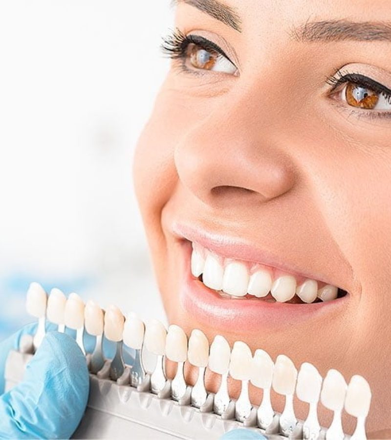 Dentist choosing the right color before the production of dental veneers in Turkey and France