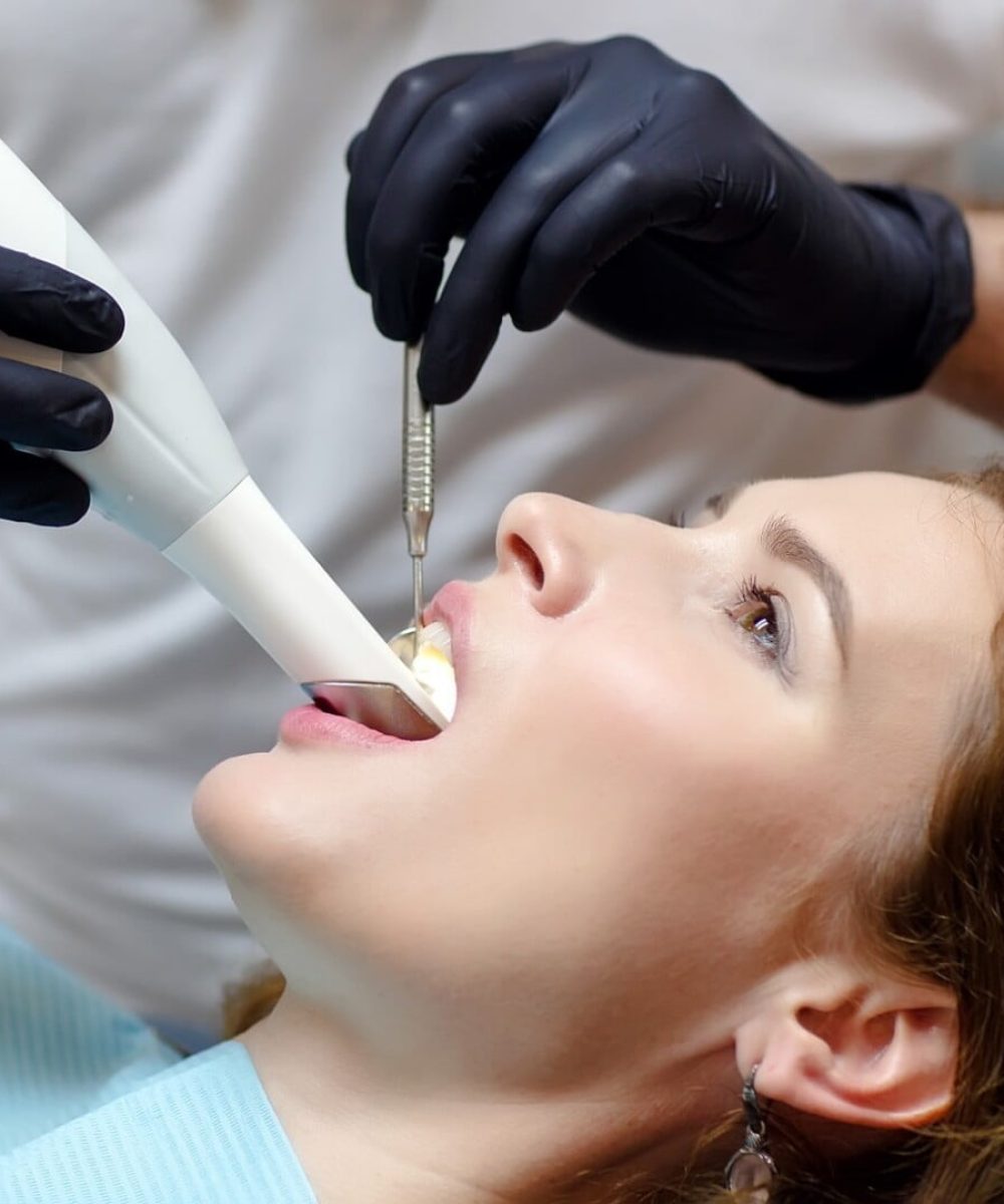 Scan intra-oral 3D à Constantine en Algérie au Naoufel Dental Center, Clinique dentaire à Constantine en Algérie, Cabinet dentaire à Constantine en Algérie.