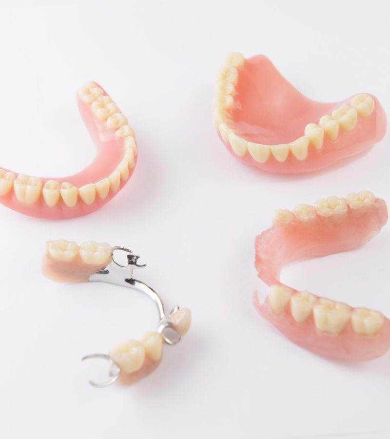 types of removable dentures, partial removable dentures and complete removable dentures